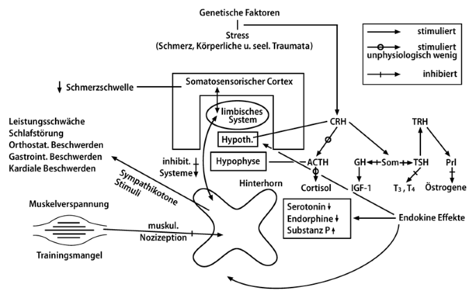 Fibromyalgie Ein Update Springerlink