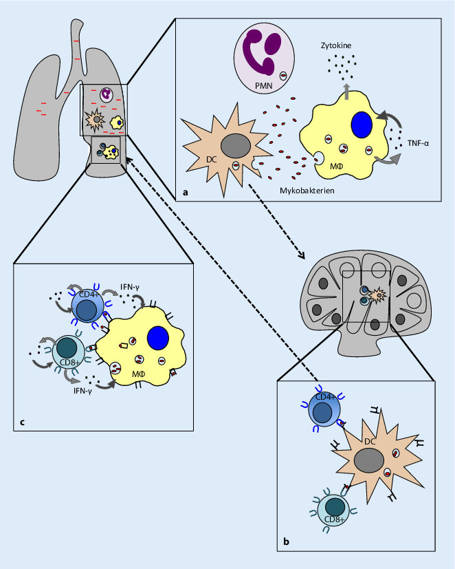 Immunität gegen Mycobacterium tuberculosis SpringerLink