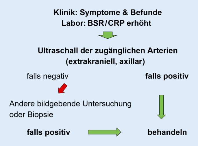 Grossgefassvaskulitiden Riesenzellarteriitis Und Takayasu Arteriitis Springerlink