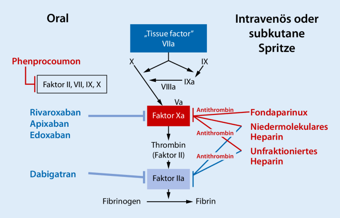 Moderne Therapie tiefer Venenthrombosen und der Lungenarterienembolie |  SpringerLink