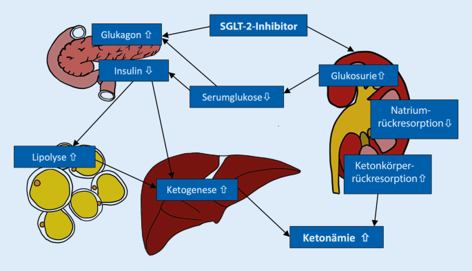 Bewusstseinsstörung, Tachypnoe und Tachykardie bei einem 71-jährigen  Patienten mit Diabetes mellitus Typ 2 | SpringerLink