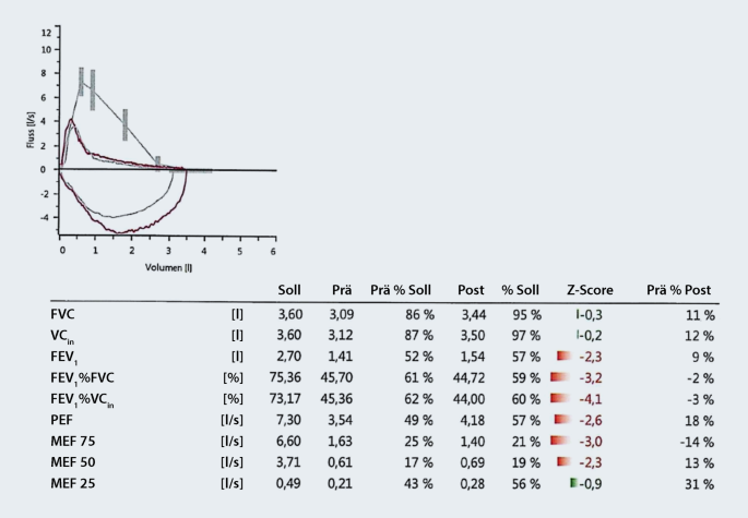 67 M Mit Langsam Zunehmender Dyspnoe Und Husten Springerlink