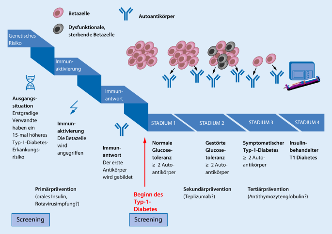 Neues in der Therapie des Typ-1-Diabetes-mellitus im Kindes- und  Jugendalter | SpringerLink