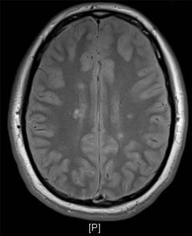 Die Entwicklung von beliebteste steroide