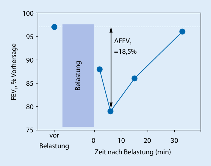 Schlecht lungenfunktionstest Lungenfunktionstest