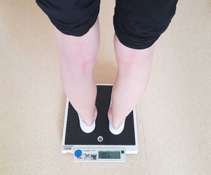 anorexia nervosa zahlen figure 1