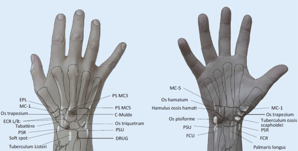 Teil‑)Arthrodesen am Handgelenk | SpringerLink