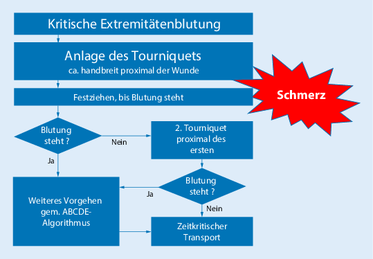 Prahospitale Anwendung Von Tourniquets Bei Lebensbedrohlichen Extremitatenblutungen Springerlink