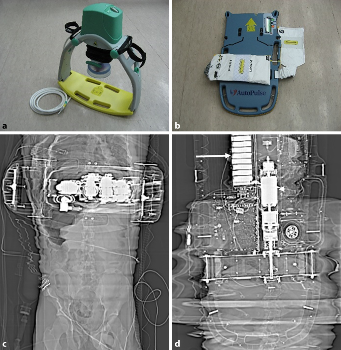 Update Polytrauma Und Computertomographie Unter Reanimationsbedingungen Springerlink