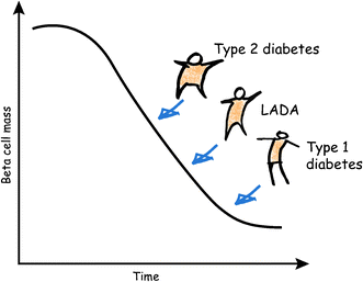 Latent autoimmune diabetes in adults: a guide for the perplexed |  SpringerLink