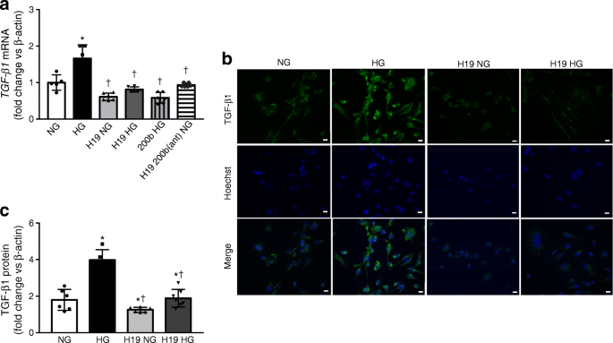 Lncrna H19 Prevents Endothelial Mesenchymal Transition In Diabetic Retinopathy Springerlink