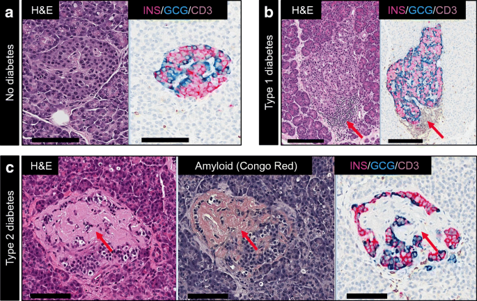 Organisation Of The Human Pancreas In Health And In Diabetes Springerlink