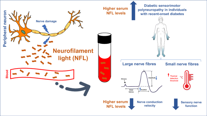Opdater underskud Forblive Serum neurofilament light chain: a novel biomarker for early diabetic  sensorimotor polyneuropathy | SpringerLink