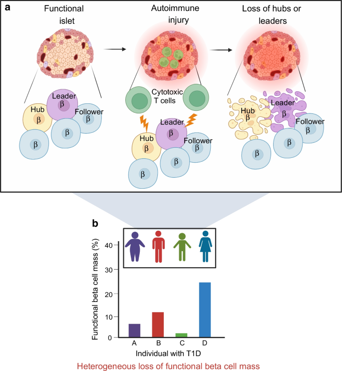 islet research type 1 diabetes figure 2