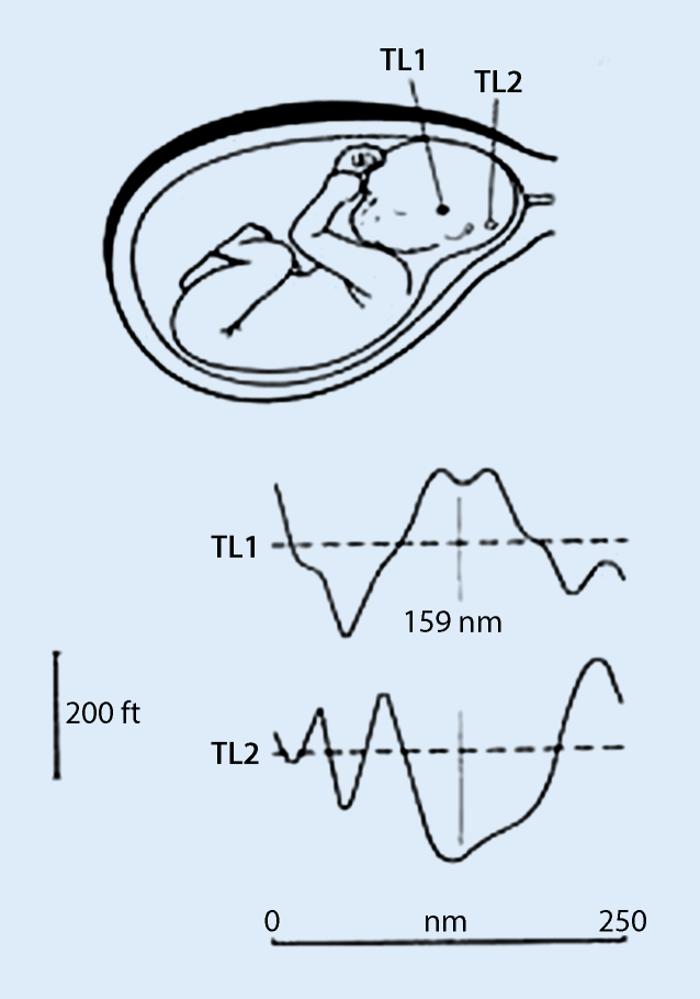 Environmental Enrichment Und Schwangerschaft Springerlink