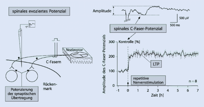 Neuronale Mechanismen der Schmerzchronifizierung | SpringerLink