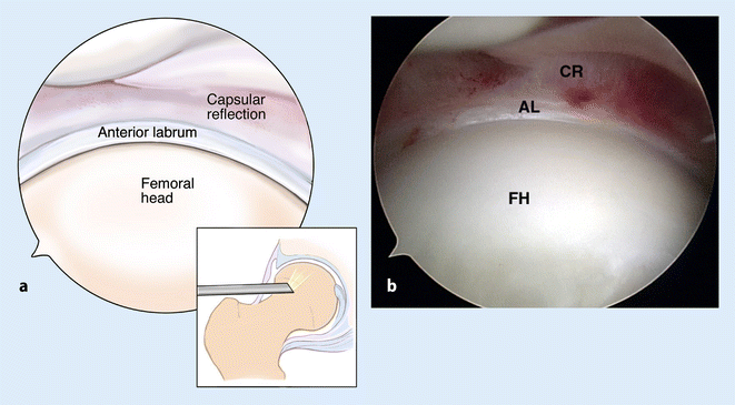 figure 23