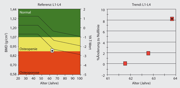 Aktuelle Diagnostik Und Therapie Der Osteoporose Auf Der Basis Der European Guidance 2008 Springerlink