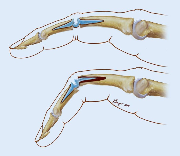 pflanzstäbe 3m Hochwertige Pflanzstäbe aus GFK für Ihre Pflanzen – Fibrolux