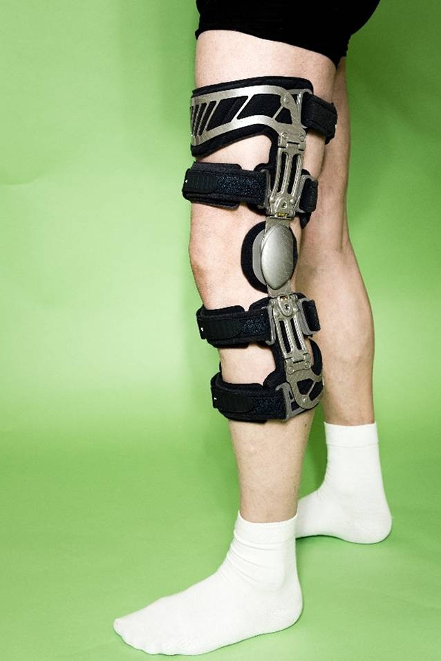 Einlagen, Knie- und Unterschenkelorthesen in der Behandlung der medialen  Gonarthrose | SpringerLink
