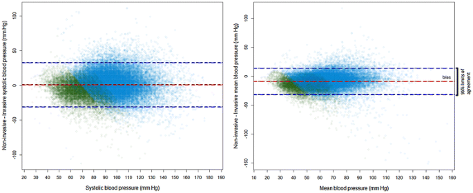 Risk Of Over Diagnosis Of Hypotension In Children A Comparative Analysis Of Over 50 000 Blood Pressure Measurements Springerlink