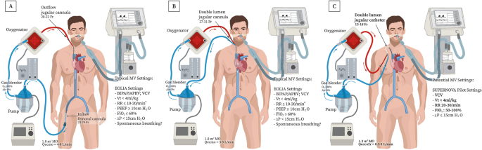 Extracorporeal life support for adults with acute respiratory distress  syndrome | SpringerLink