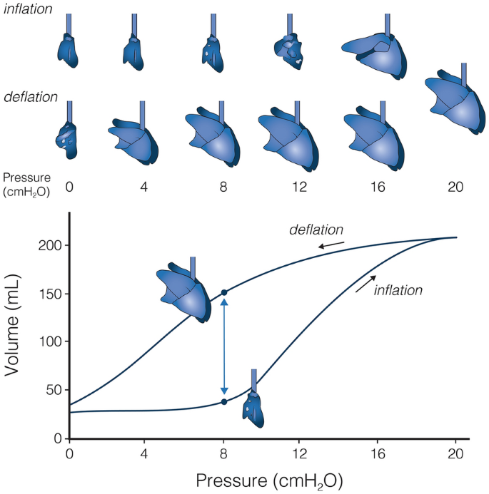 Lung recruitment | Intensive Care Medicine