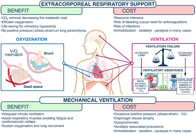The physiological underpinnings of life-saving respiratory support |  SpringerLink