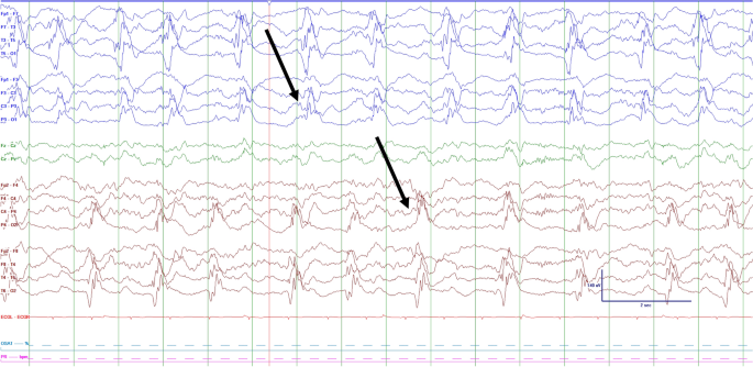 figure 11