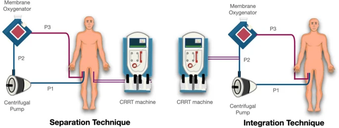 [Intensive Care Med发表论文]：需要CRRT支持的ECMO患者管路整合与分离时管路寿命的比较