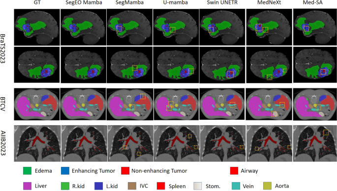 A Mamba-optimized decoder for improved medical image segmentation ...