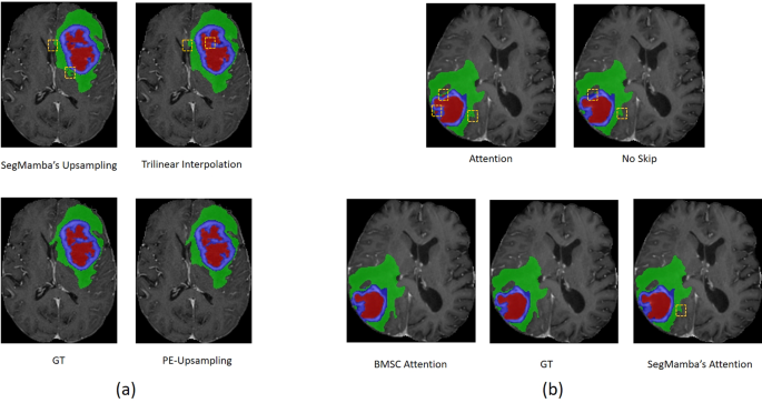 A Mamba-optimized decoder for improved medical image segmentation ...
