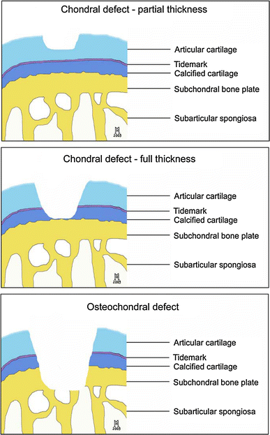 The basic science of the subchondral bone | SpringerLink