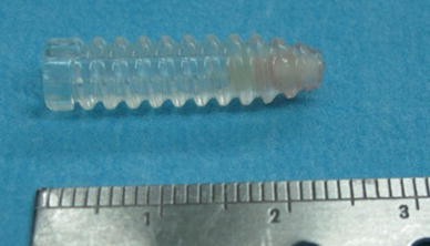 Migration Of Bioabsorbable Screws In Acl Repair How Much Do We Know A Systematic Review Springerlink Migration Of Bioabsorbable Screws In Acl Repair How Much Do We Know A Systematic Review Springerlink