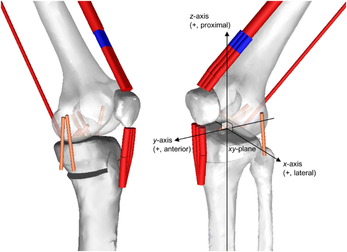 FlexBone Training Model - Tibia Bone