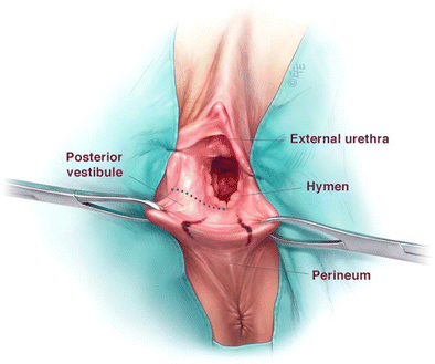 figure 40