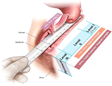 figure 41