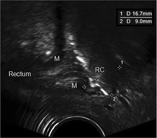 figure 17