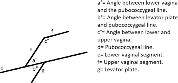 Vaginal Axis On Mri After Laparoscopic Lateral Mesh Suspension Surgery A Controlled Study Springerlink