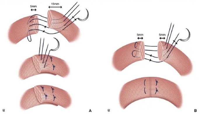 figure 22