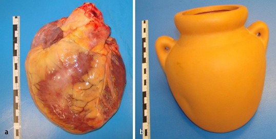 Tako tsubo tintenfischfalle Clearance