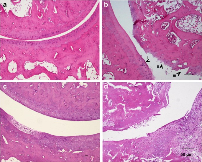 Galactomannan Of Delonix Regia Seeds Reduces Nociception And Morphological Damage In The Rat Model Of Osteoarthritis Induced By Sodium Monoiodoacetate Springerlink