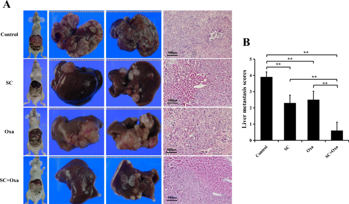 Anti-Cancer Effect of Sophocarpine