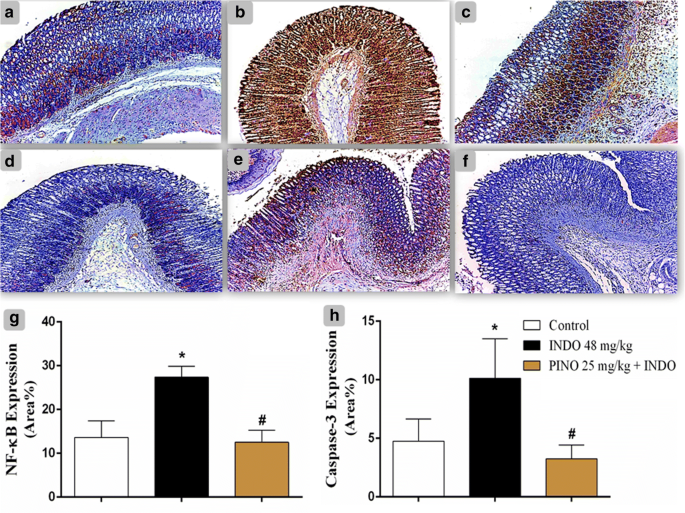 Protective and therapeutic effects of the flavonoid 