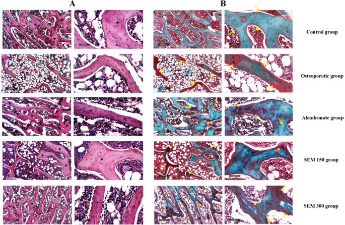 The crucial role of beta-catenin in the osteoprotective effect of  semaglutide in an ovariectomized rat model of osteoporosis |  Naunyn-Schmiedeberg's Archives of Pharmacology