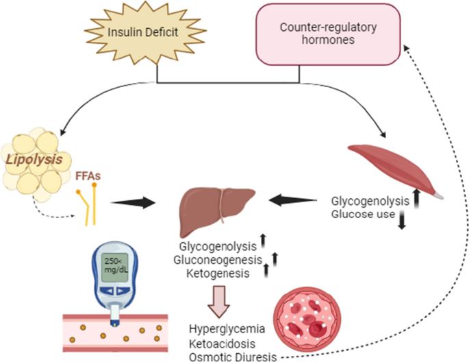 does glp 1 put you in ketosis GLP-1 mimetics and diabetic ketoacidosis: possible interactions and  clinical consequences | Naunyn-Schmiedeberg's Archives of Pharmacology