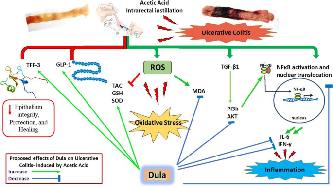 ulcerative colitis glp 1 Protective effect of Dulaglutide, a GLP1 agonist, on acetic acid-induced ulcerative  colitis in rats: involvement of GLP-1, TFF-3, and TGF-β/PI3K/NF-κB  signaling pathway | Naunyn-Schmiedeberg's Archives of Pharmacology