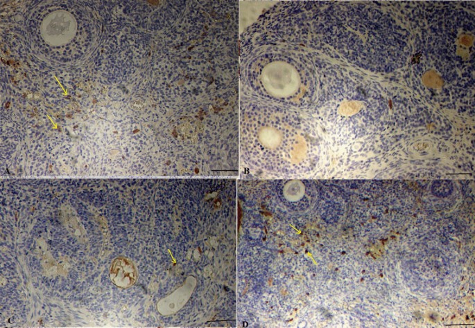 does l carnitine increase estrogen L-carnitine improves polycystic ovary syndrome by increasing CYP11A1,  estrogen receptor, and decreasing XNIP and VEGF expression |  Naunyn-Schmiedeberg's Archives of Pharmacology