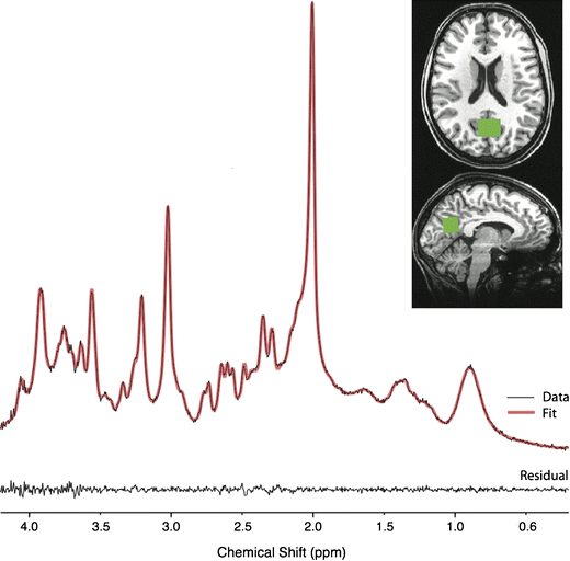 Cortical glutathione levels in young people with bipolar disorder: a pilot  study using magnetic resonance spectroscopy | Psychopharmacology