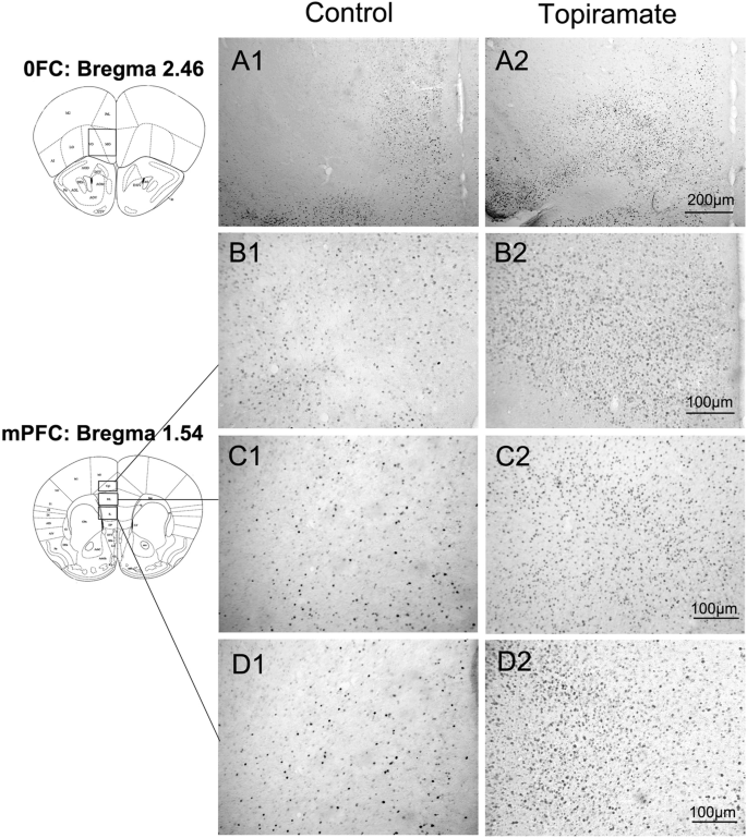 The Effects Of Topiramate On Isolation Induced Aggression A